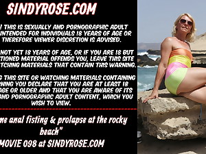 Extraordinary anal fisting & prolapse at the rocky beach